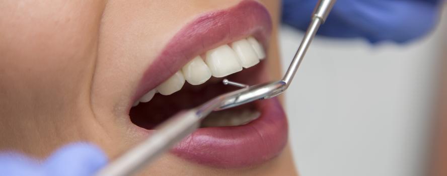 Preventative Dentistry in Saint Clair